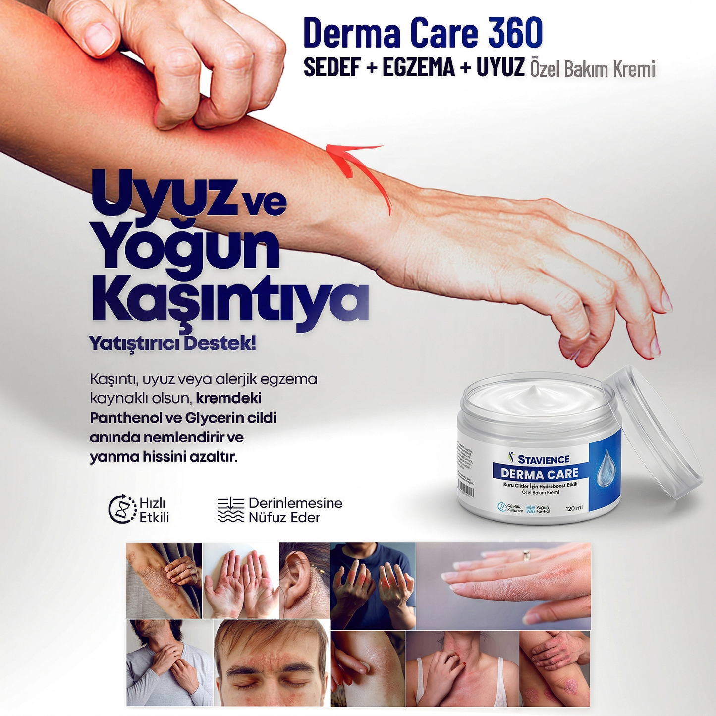 Derma Care 360 - Sedef, Egzema ve Cilt Problemlerine Özel Bakım Kremi 120Ml